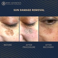 Laser Clinic Southend - Body Aesthetics